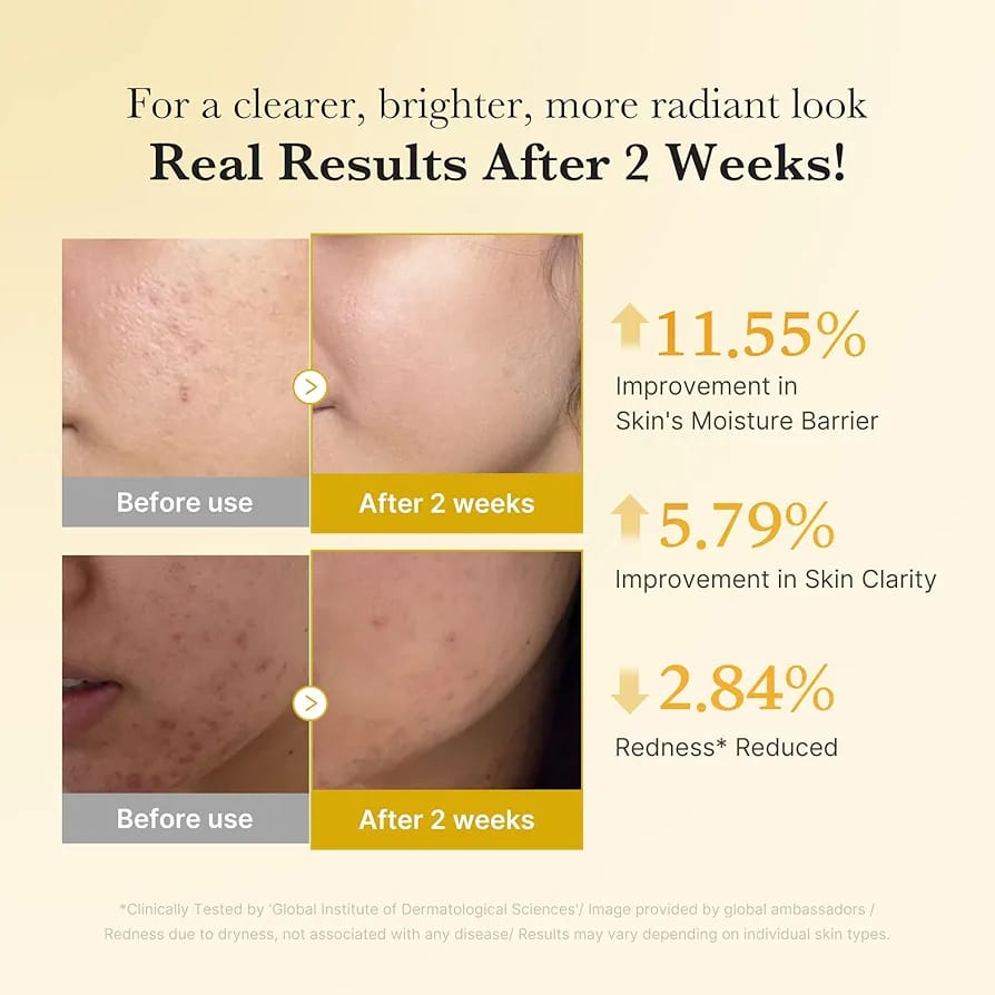 Synthesis Glow™ Medicube Kojic Acid Turmeric Capsule Serum